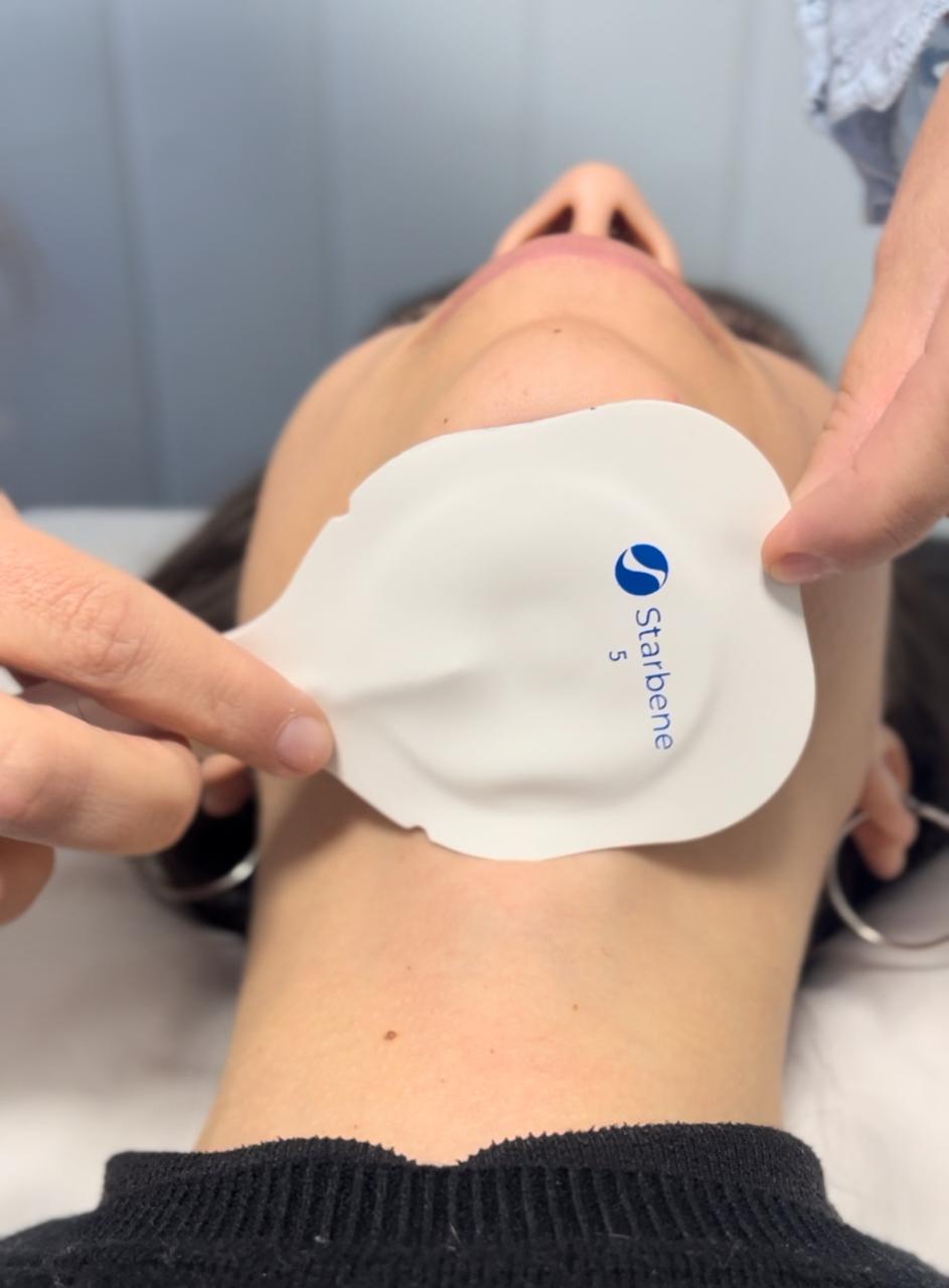 Elevación Facial - ELIX
